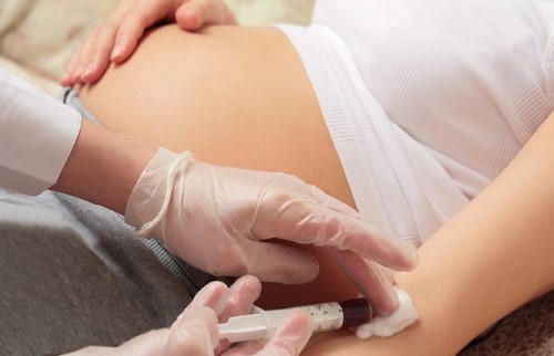 Non İnvazif Prenatal Test (NIPT)